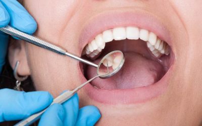 Thankful For a Root Canal? The Power of Positive Thinking