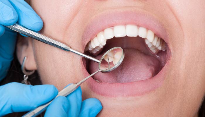 Thankful For a Root Canal? The Power of Positive Thinking